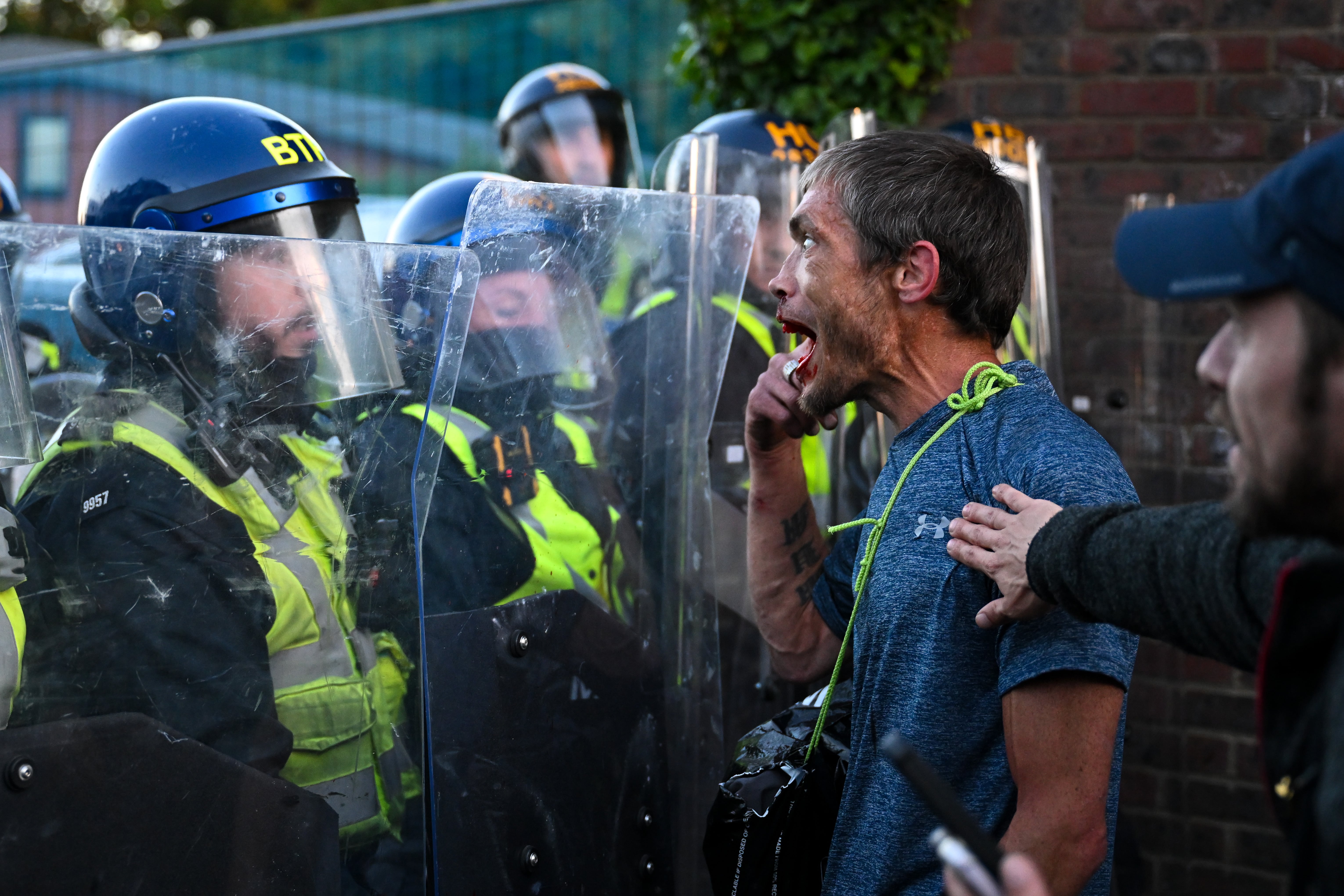 Protests erupt in UK over police handling of teenager's death