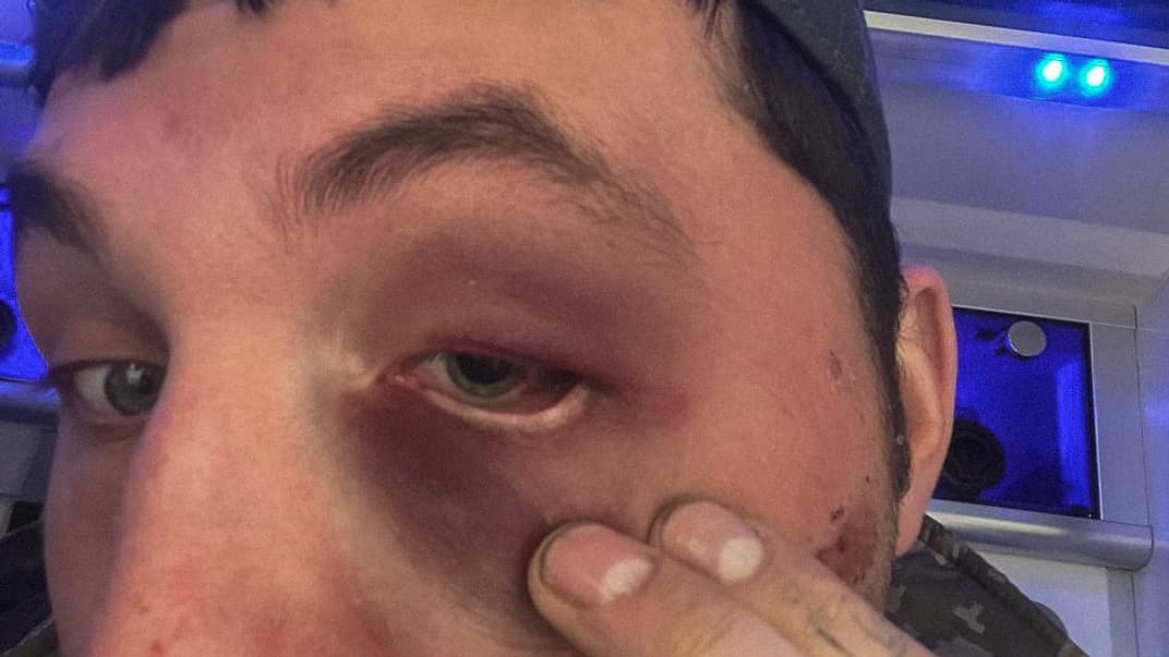 Петр Злотя после избиения