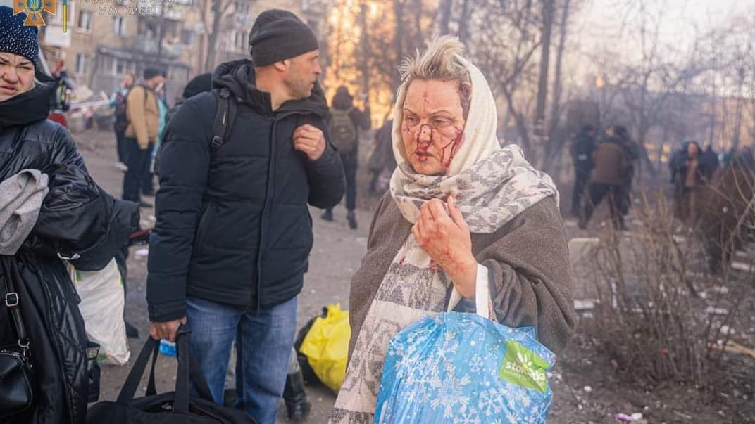 Женщина, пострадавшая в результате атаки на Киев