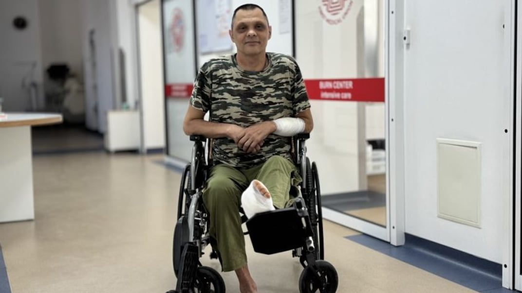 Чоловік, якого львівські лікарі врятували від ампутації