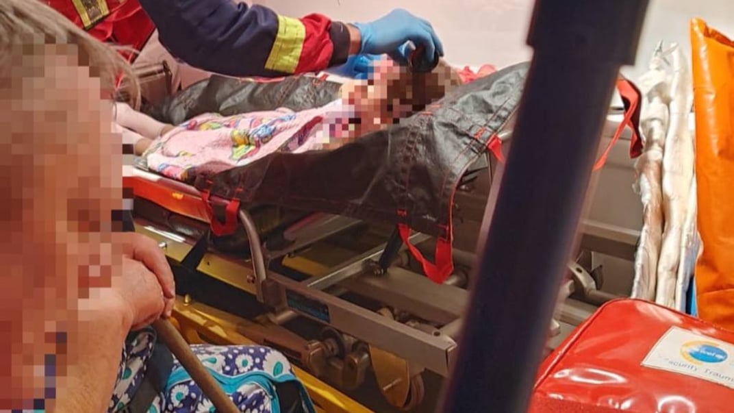 Пострадавшей девочке оказывают помощь