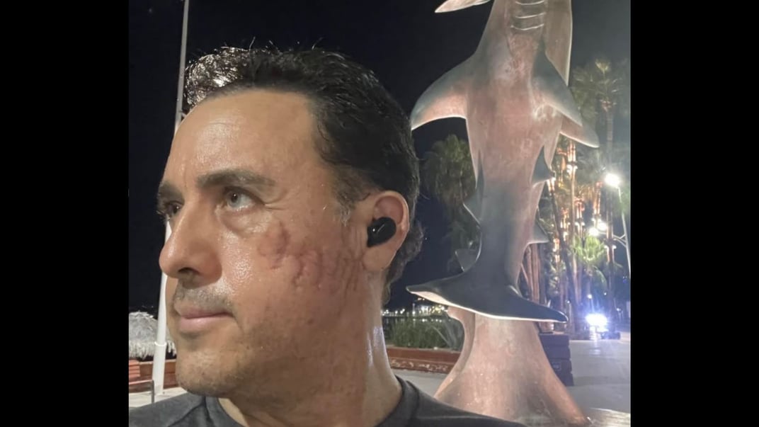 Мексиканський біолог Маурісіо Ойос, який вижив після нападу акули