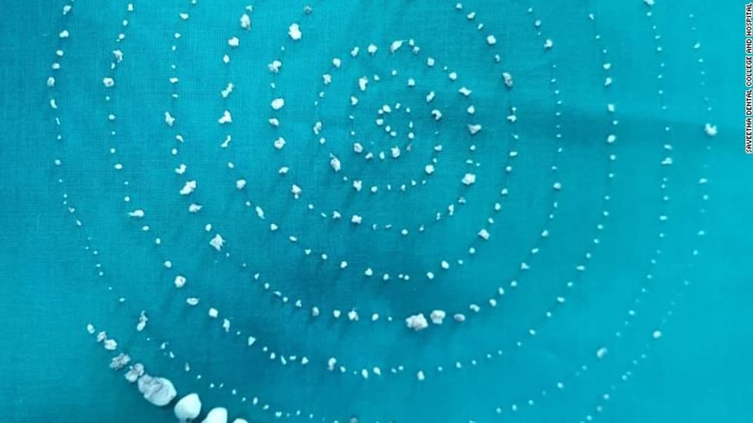 Часть вытянутых дентикул