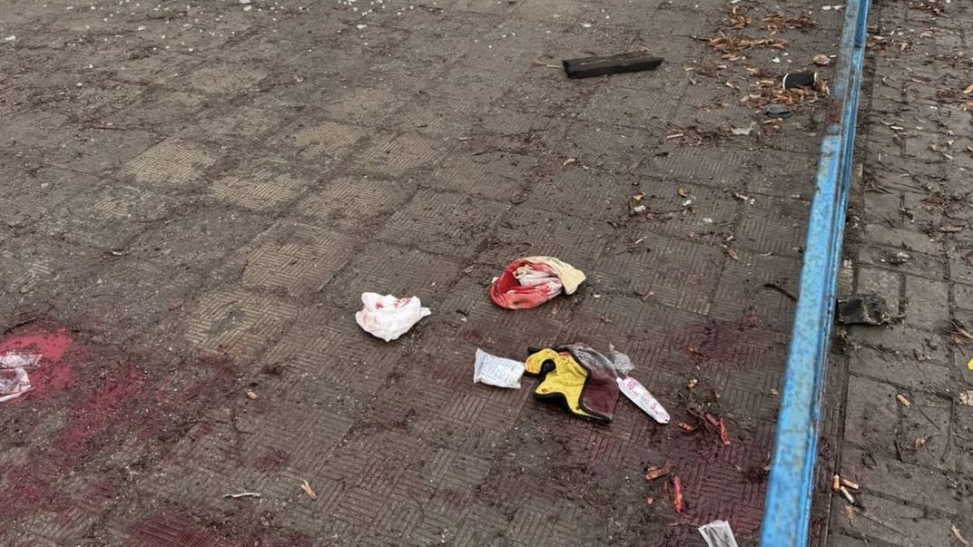 Оккупанты атаковали админздание в Сумах: пострадал подросток