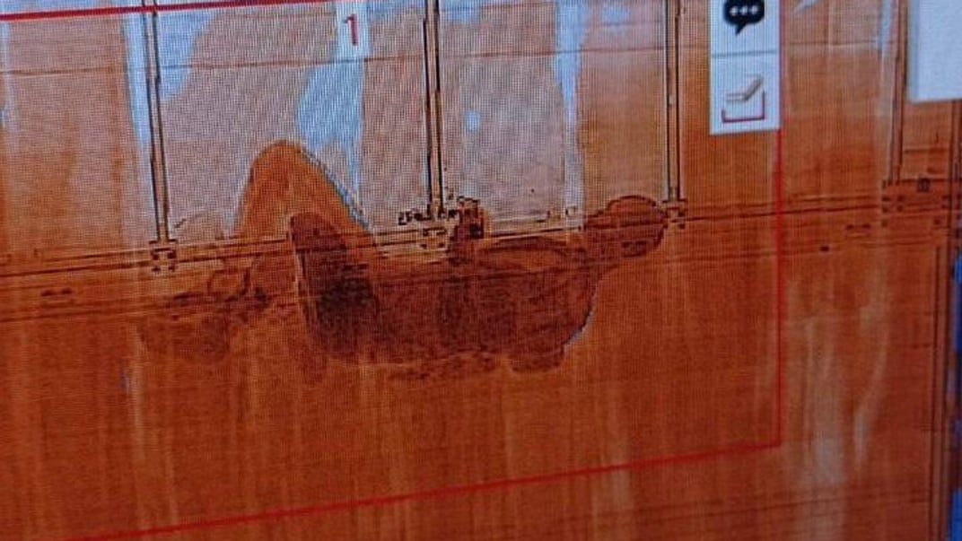 Зображення сканера, на якому видно силует, схожий на постать людини