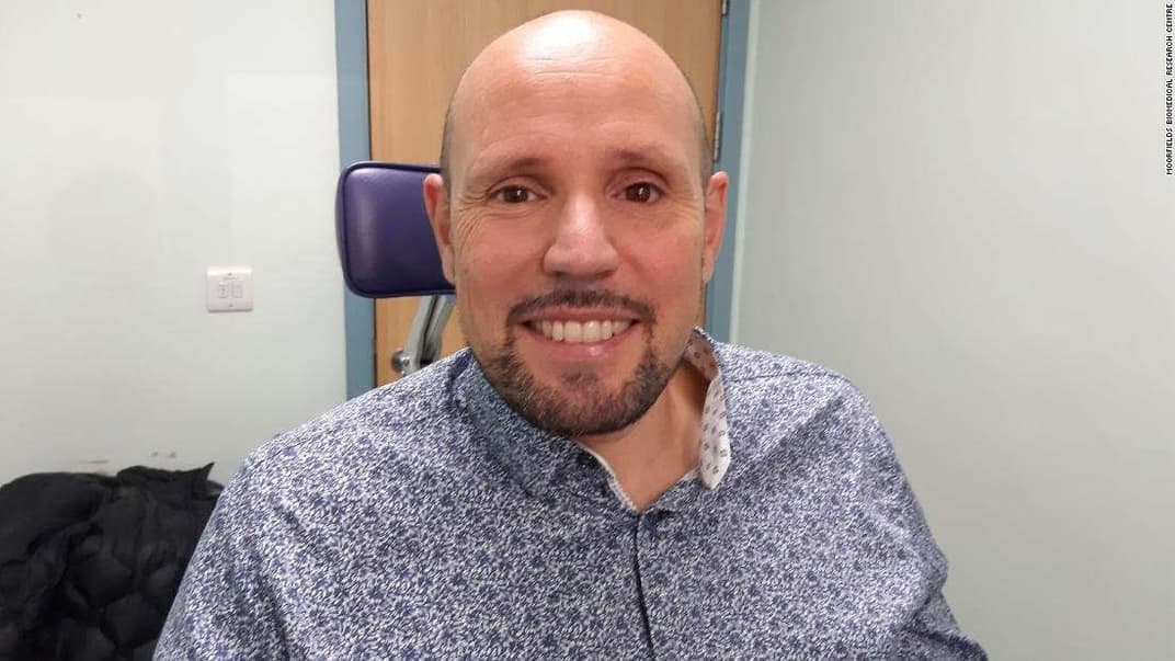 Мужчина, которому впервые в мире установили напечатанный на 3D-принтере протез глаза