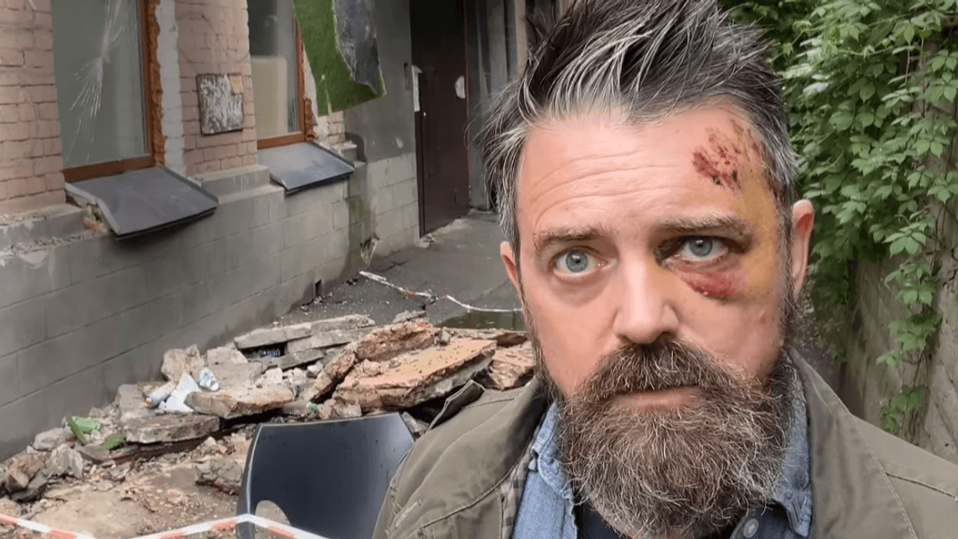 Крістофер Волтерс після падіння балкона у Києві