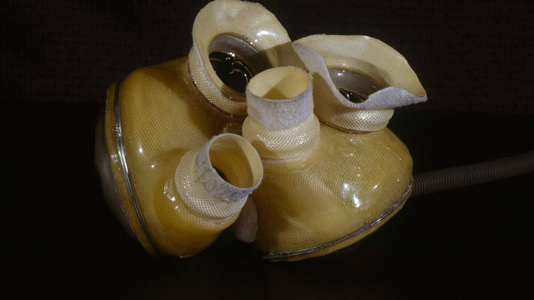 Искусственное сердце Jarvik 7, которое было имплантировано доктору Барни Кларку 8 декабря 1982 года