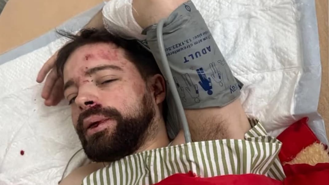 Степан Більченко