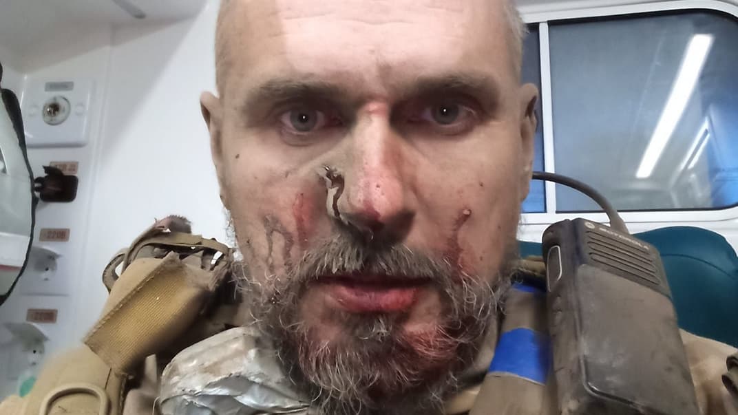 Олег Сенцов отримав пораненні на фронті, фото опубліковане 17 липня 2023 року