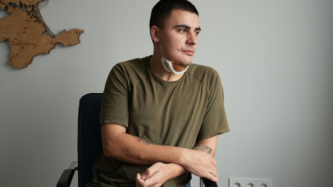 Военный Андрей Грушко, которому провели операцию по реконструкции нижней челюсти