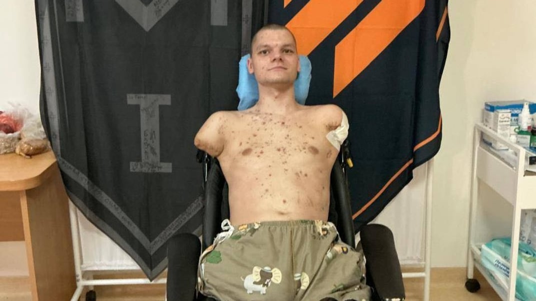 20-річний ветеран, якому, за словами Олени Толкачової, відмовили у відновленні картки