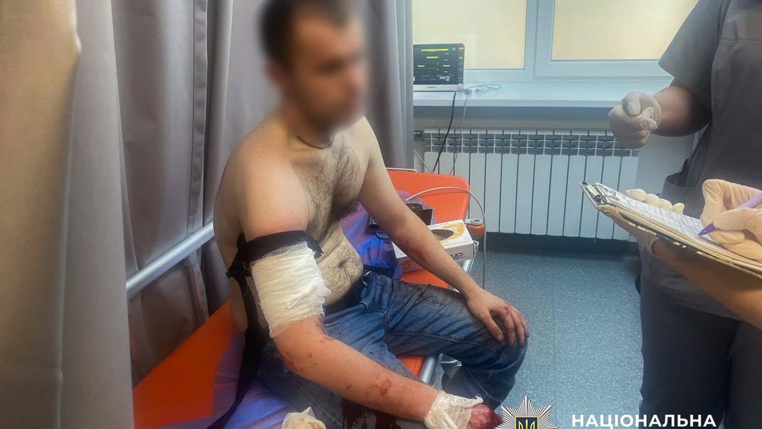 У Запоріжжі застрелили чоловіка, який напав з ножем на правоохоронців