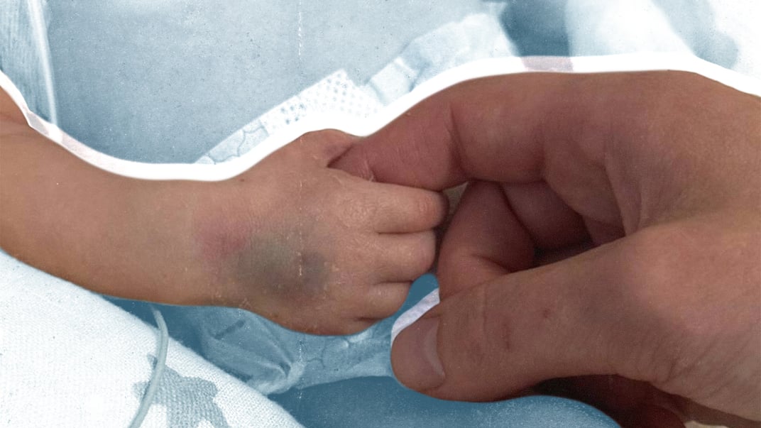 Сирота з живим батьком. Історія Назарчика, який народився після обстрілу Києва