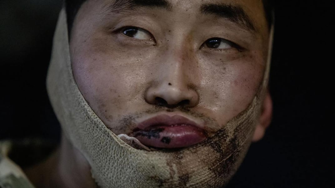 Один із полонених військових КНДР, на ім'я Рі