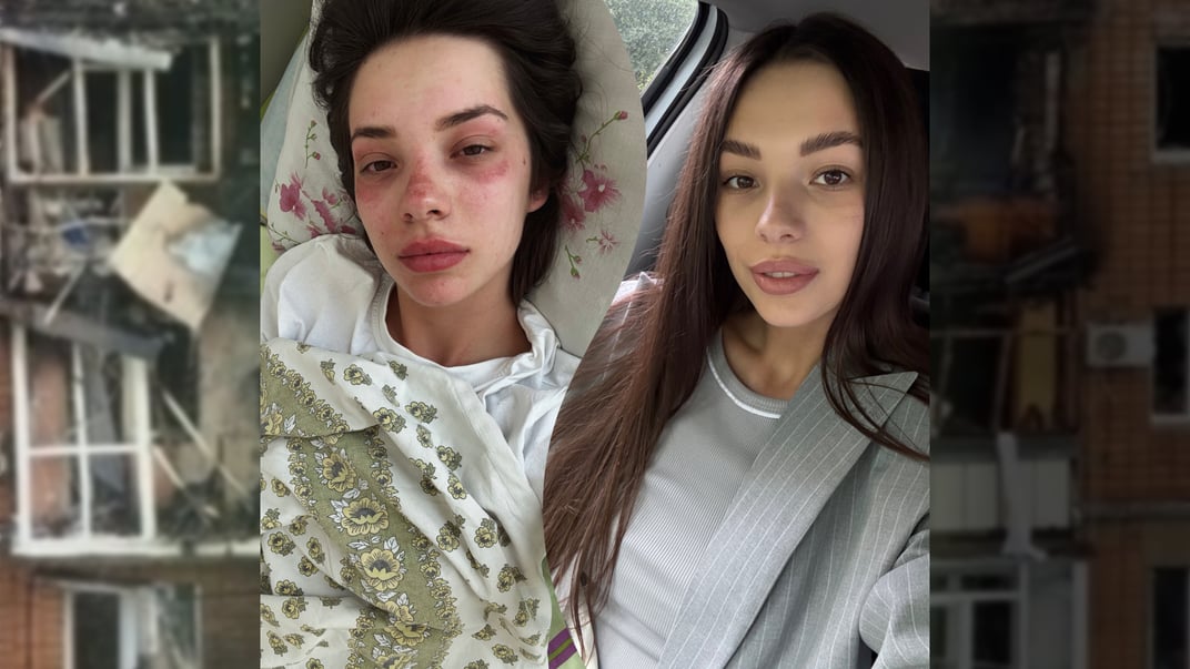 Потерпевшая от удара «шахеда» Мария