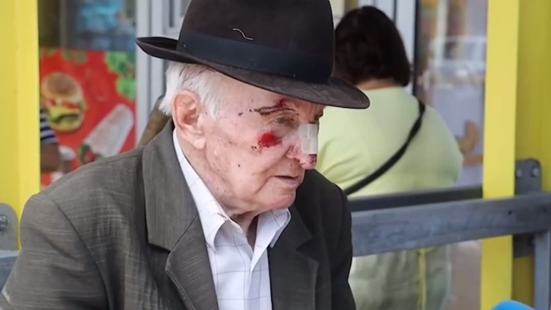 Раненый мужчина в Днепре после российского обстрела города, 3 июля 2024 года