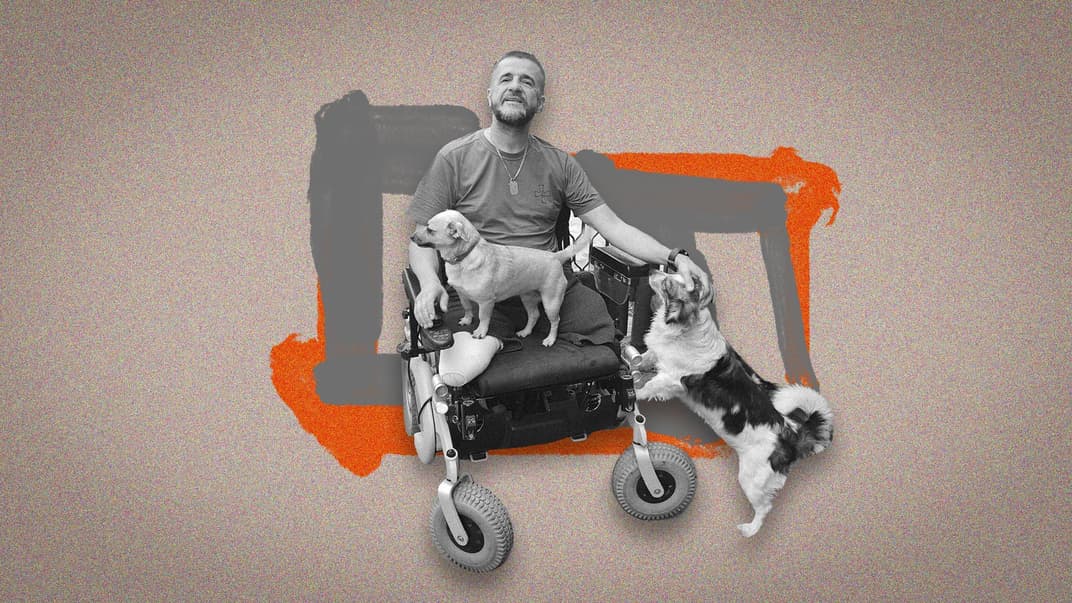 57-летний тяжелораненый военный Олег Дубовой из Тернопольской области