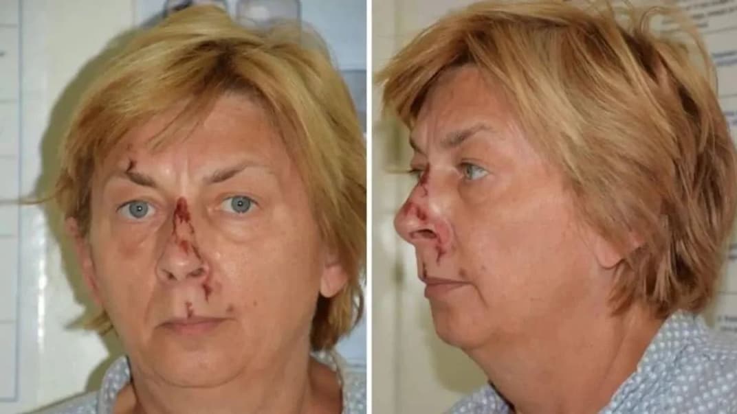 57-річна Дана Адамцова була знайдена на хорватському острові Крк 12 вересня. Жінка забула, хто вона, звідки і як її звати