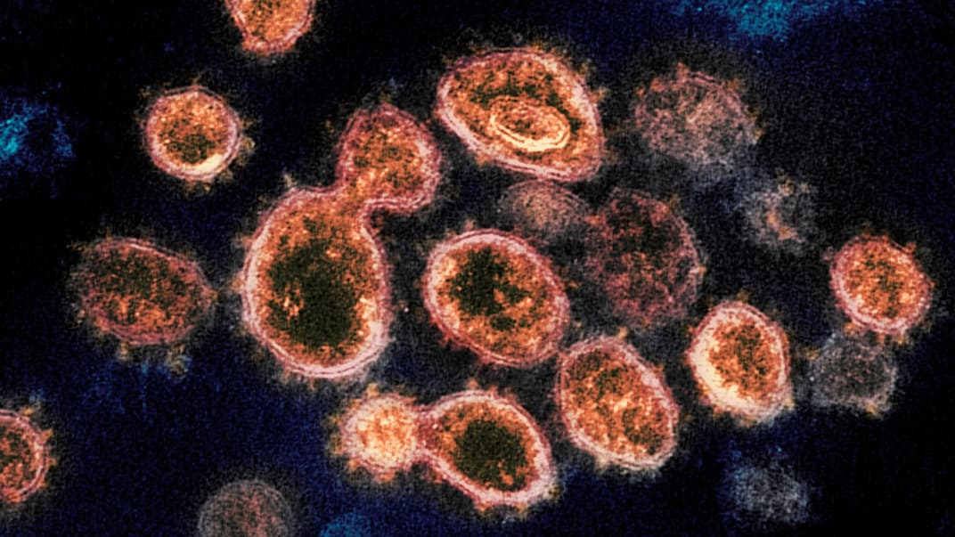 Зображення електронного мікроскопа, яке показує частинки вірусу SARS-CoV-2, які викликають COVID-19