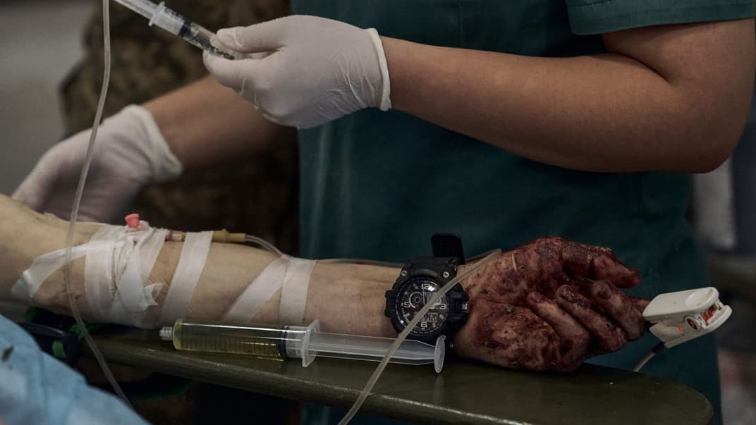 Иллюстративная фотография. Окровавленная рука раненого украинского военного, который получает первую помощь в медицинском стабилизационном пункте вблизи Бахмута, 19 июня 2023 года