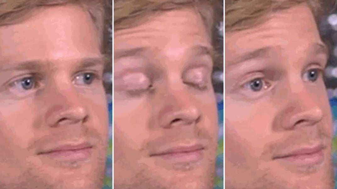 Хлопець, що кліпає