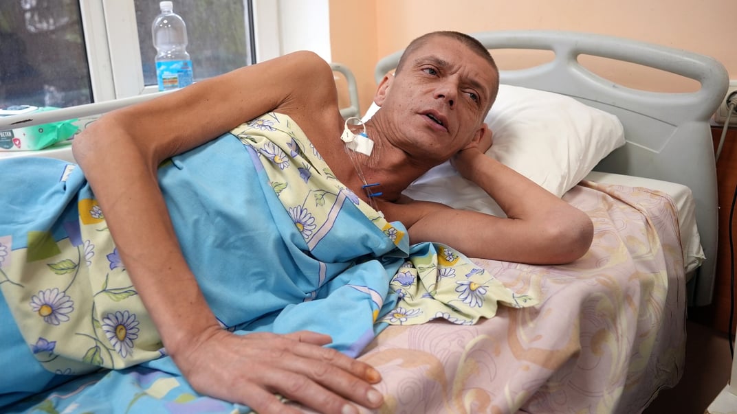 Военный Александр, который был 36 дней с турникетом на ноге