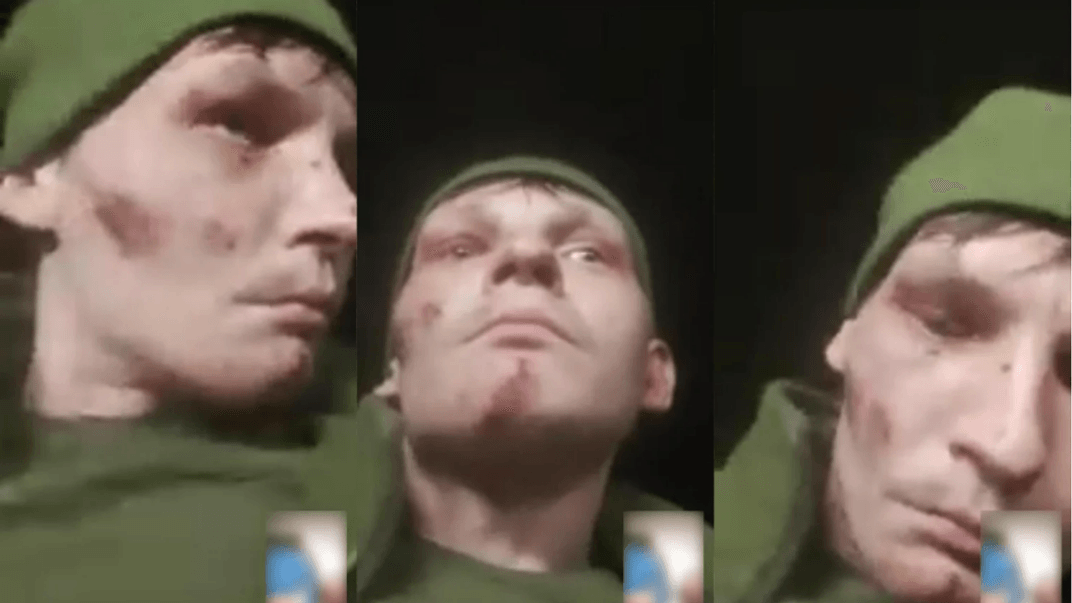 Сліди побоїв на обличчі Жикіна