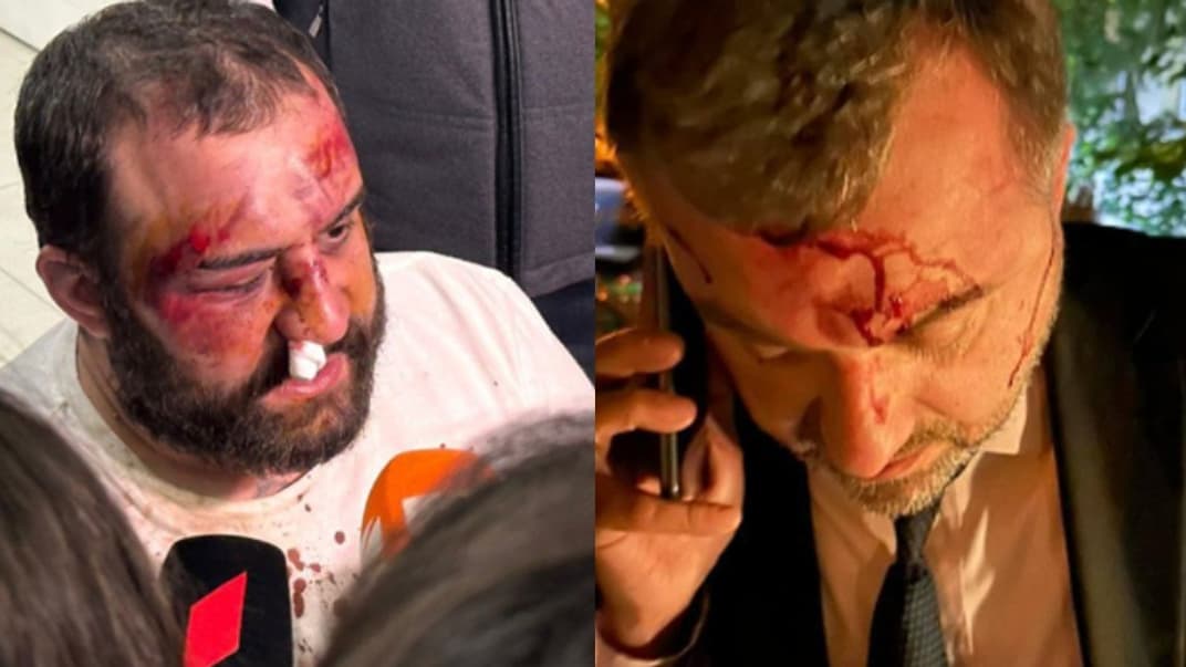 Дмитрий Чиковани и Гия Джапаридзе после избиения