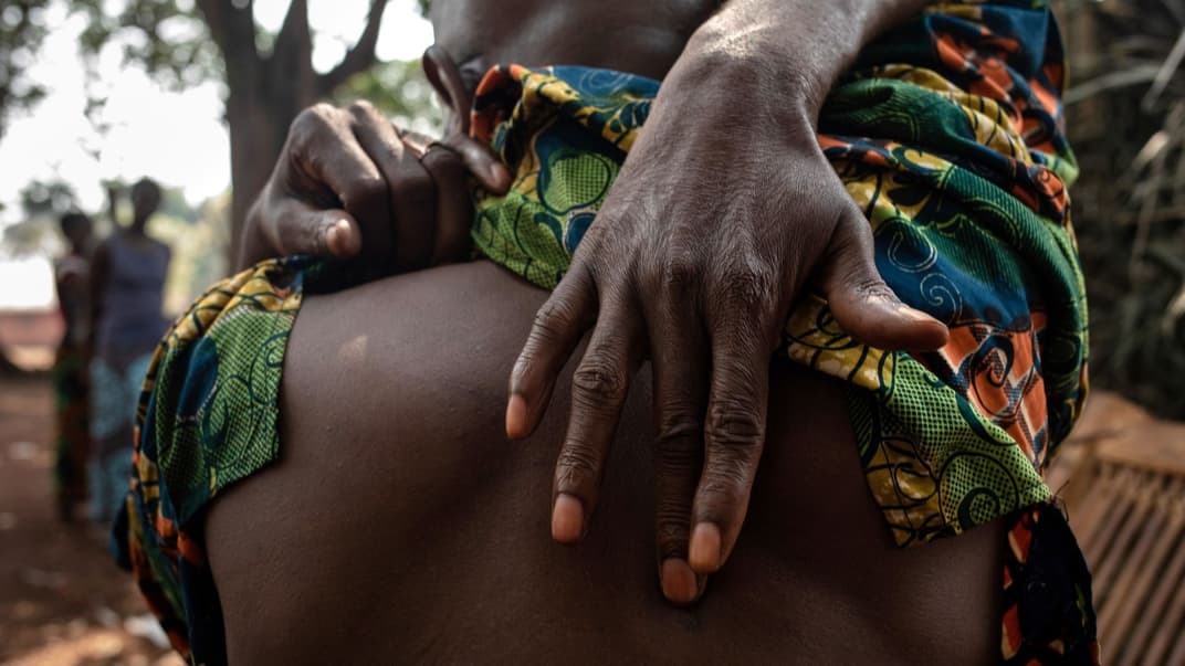 57-летний Себасте Кондо показывает шрам на спине от пули, оставшийся там с 2018 года, деревня Чезакоба в Центральноафриканской Республике, 14 февраля 2021 года