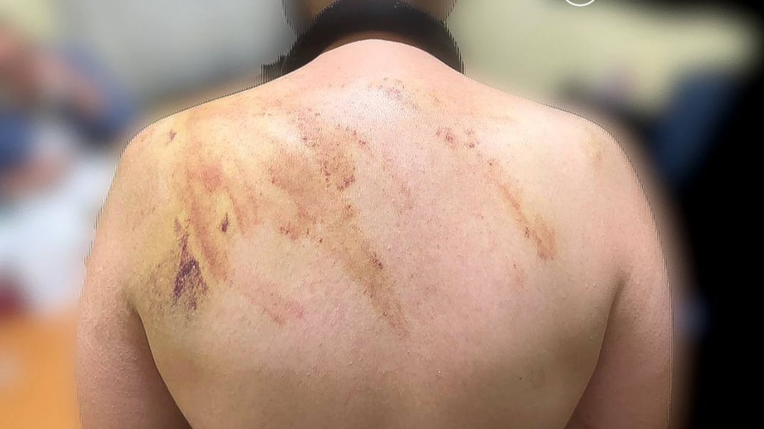 Наслідки побиття в коломийському інтернаті