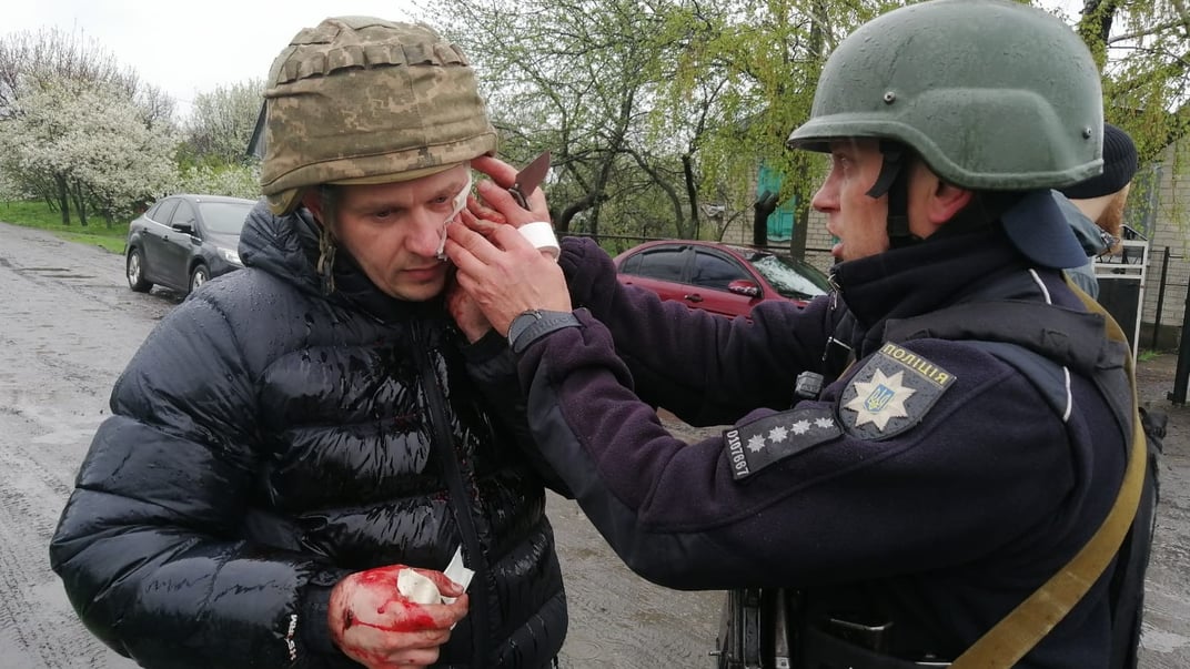 Поліціянт, поранений унаслідок вибуху гранати