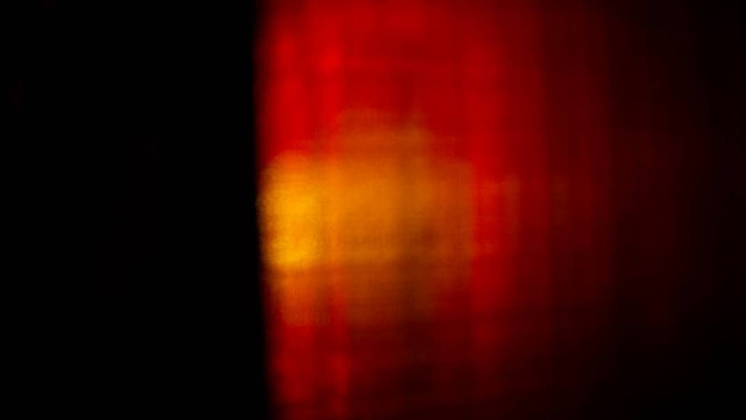 «У мене в грудях вибухнула атомна бомба» — історії депресії кінооператорки і ветерана війни на Донбасі