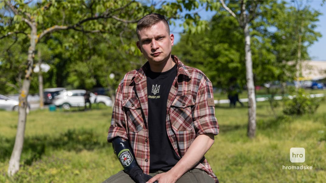 27-летний Алексис, потерявший руку на войне