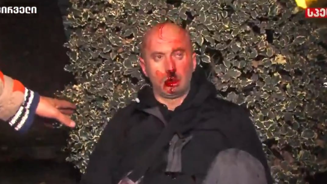 У журналіста «Формули» Гурама Рогави унаслідок сутичок на мітингу зламані кістки обличчя та шиї