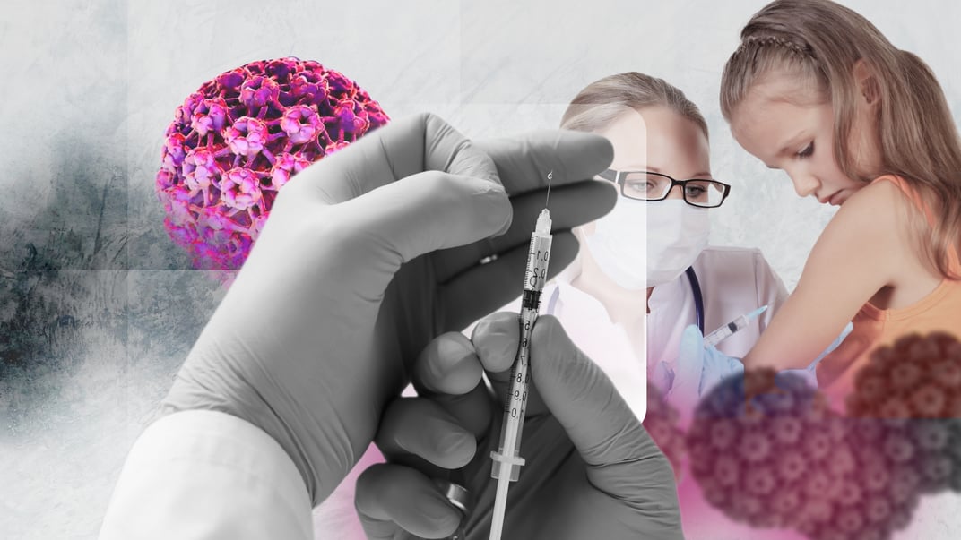 Передається через секс, викликає рак. Як захиститися від вірусу папіломи людини