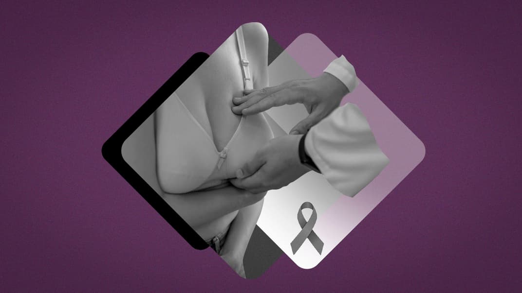 Рак молочної залози. Що небезпечніше: байдужість до свого здоров’я чи її наслідки