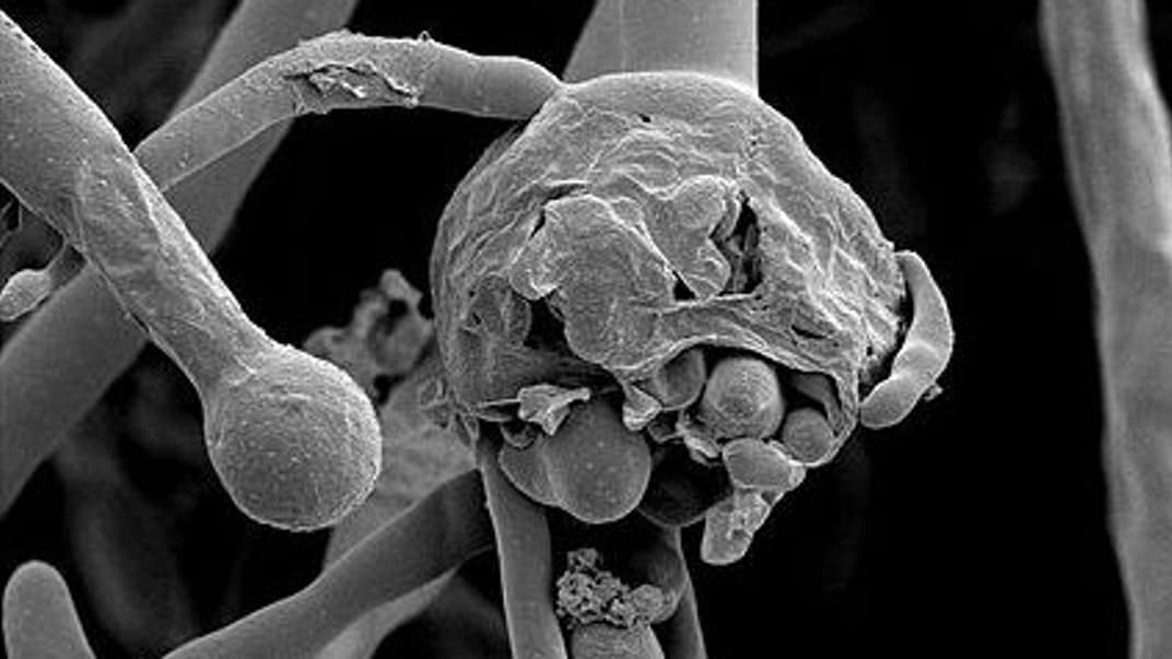 Зображення мукорового гриба, збудника мукормікозу, під мікроскопом