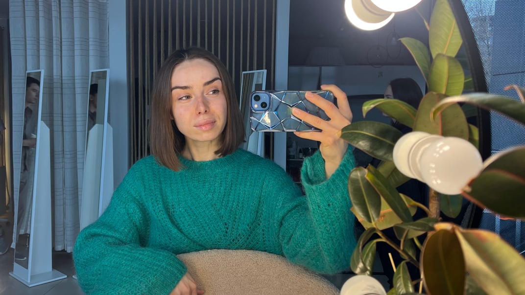 Мені 33. Шкіра схильна до висипань, сухості, пігментації, «втомленого» морфотипу. Фото зроблене після сеансу масажу «Міофасціальний ліфтинг»