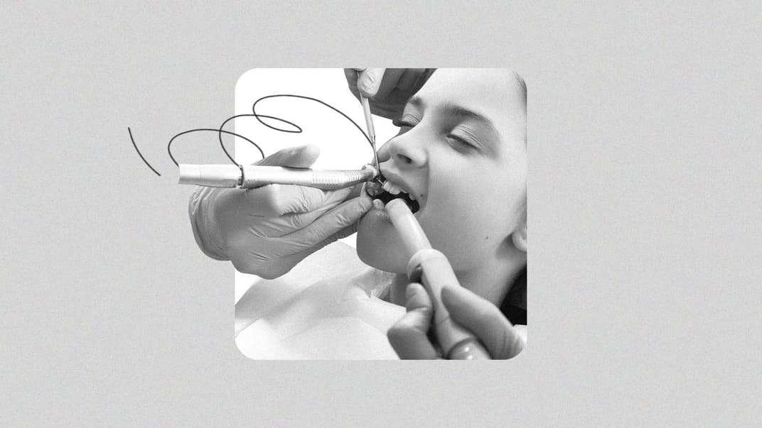 Лечение зубов ребенка под наркозом: что нужно знать