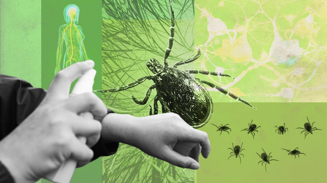 «Ще тиждень — і я б помер». Чим небезпечний бореліоз та як вижити у сезон кліщів