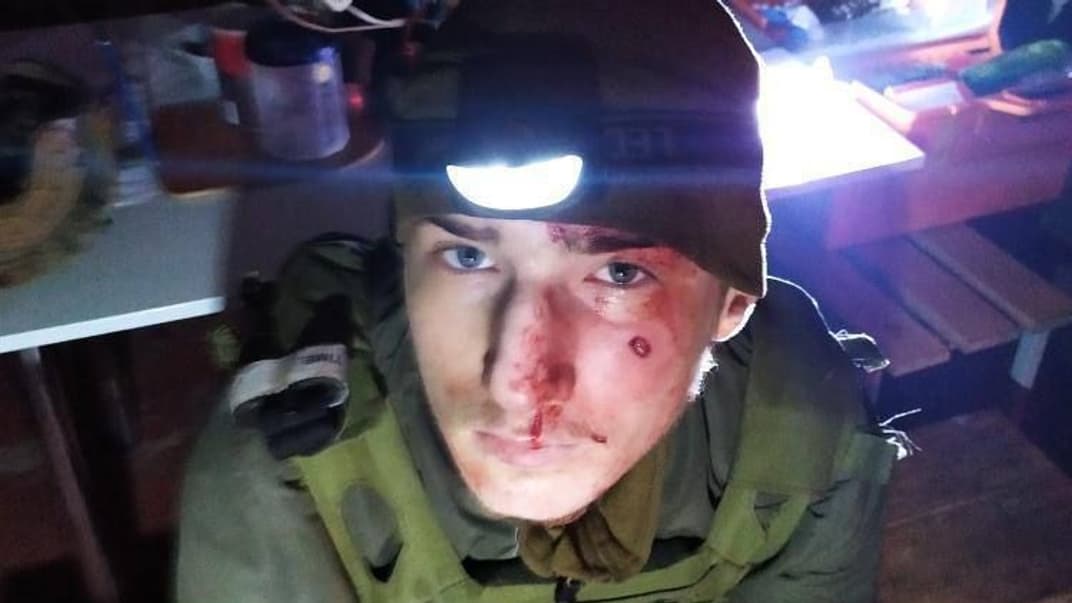 Назар Гринцевич получил осколочное ранение в лицо и перелом ребер