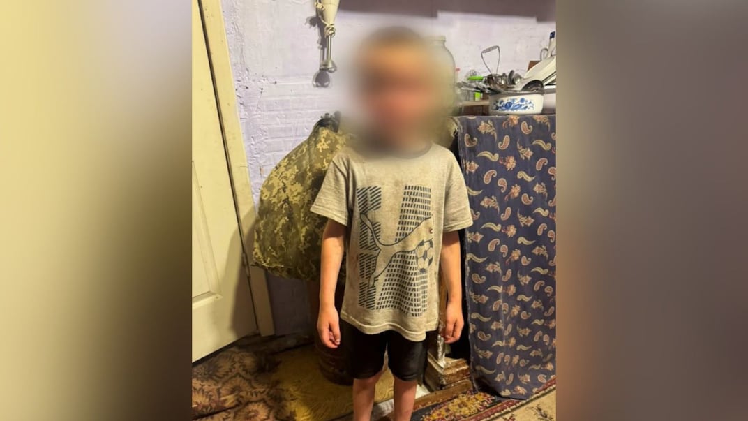 5-річний хлопчик, у якого лікарі діагностували струс головного мозку