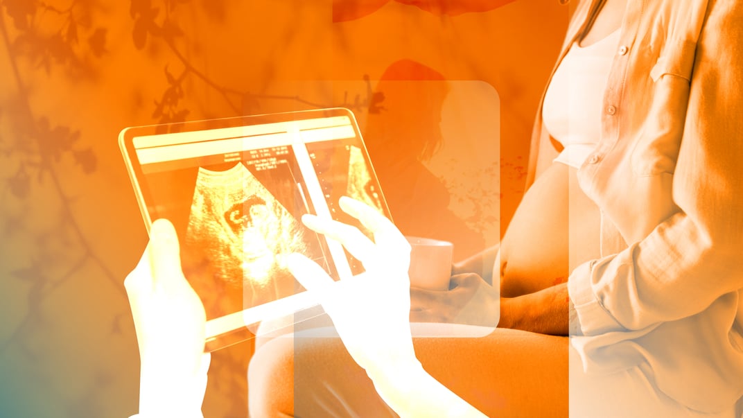 Планування вагітності. Покрокова інструкція свідомого батьківства