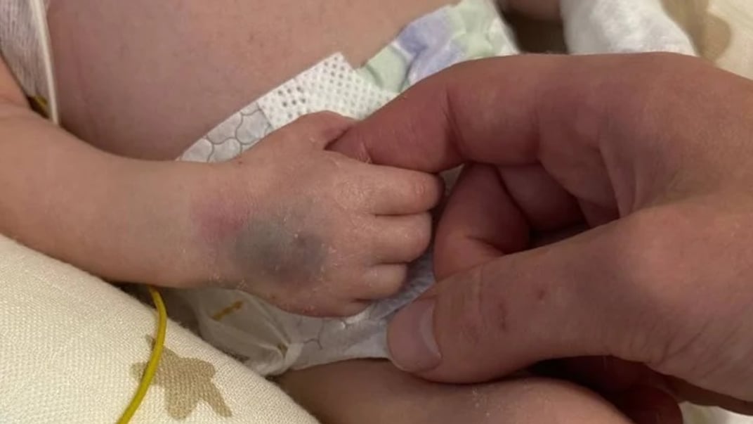 Новонароджений Назар у лікарні