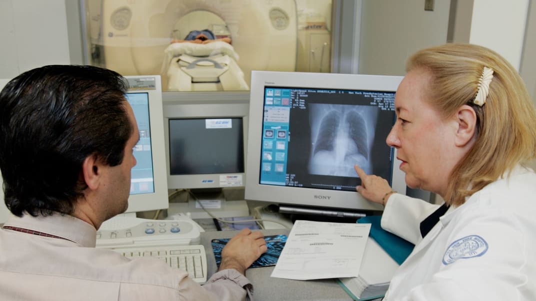 Комп’ютерна томографія здатна виявити рак легень на ранніх стадіях. Це може врятувати життя тисячам курців