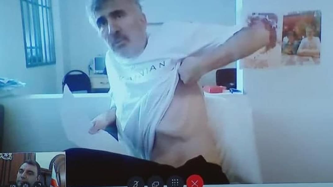 Михеил Саакашвили показывает последствия заключения, 1 февраля 2023 года