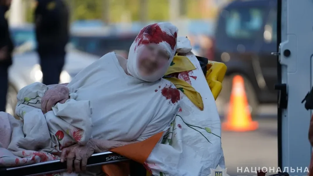 Раненая женщина после удара по гериатрическому пансионату в Сумах