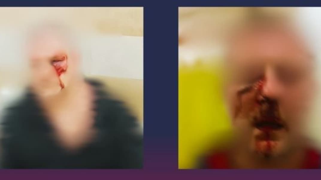 Фото потерпевших после избиения