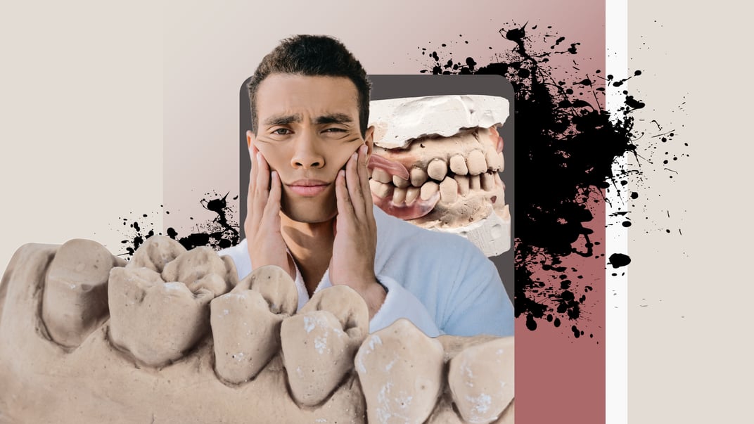 Скрегочете уві сні? Розбираємося, що таке бруксизм і чи справді причиною є глисти